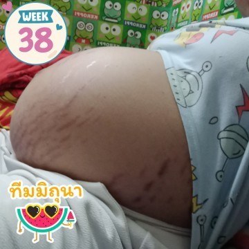 ทีมมิถุนายน64 มีอาการยังไงกันบ้างค่ะ
