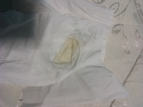 ตกขาวมีสีส้มๆ ปนๆ ด้วยค่ะ กังวลมาก