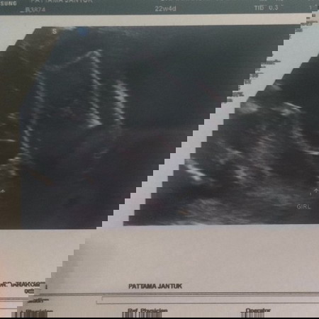 ตั้งชื่อให้หนูหน่อยค่ะ