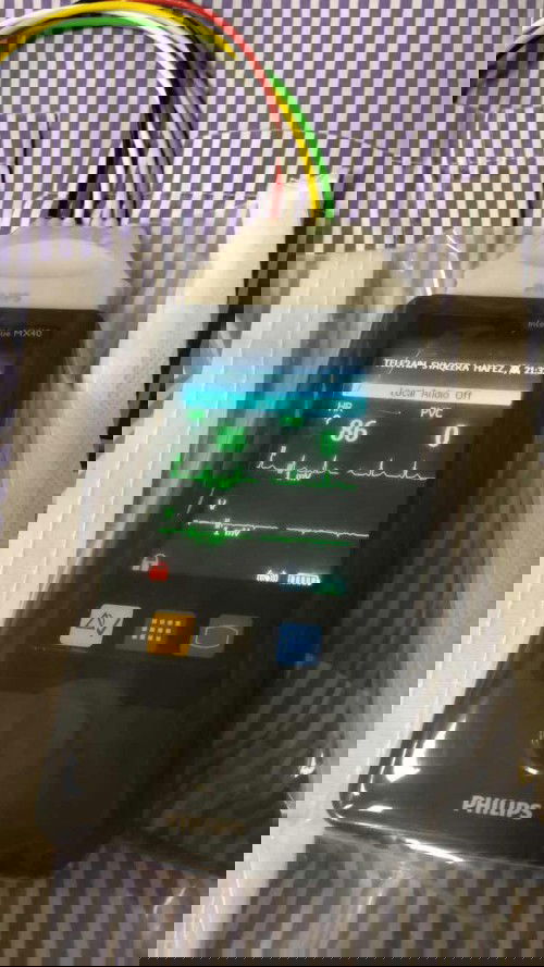 Masalah jantung masa pregnant no 3