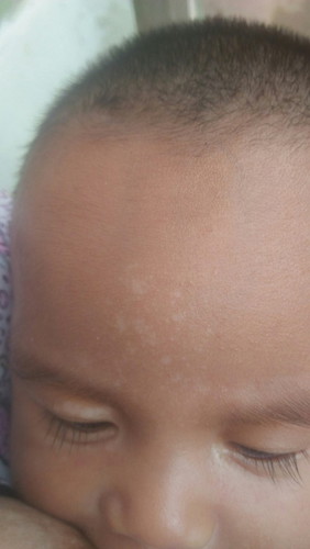 Putih di muka bayi