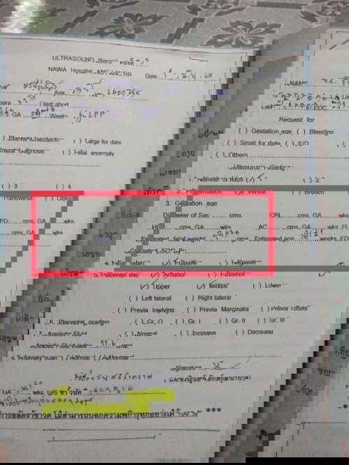 สอบถามหน่อยค่ะ