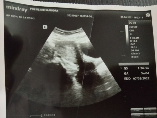 Hai korang,normal Tak 5w scan xnampak?