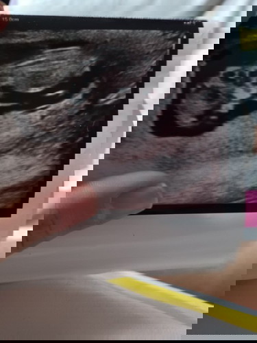 Guessing baby gender