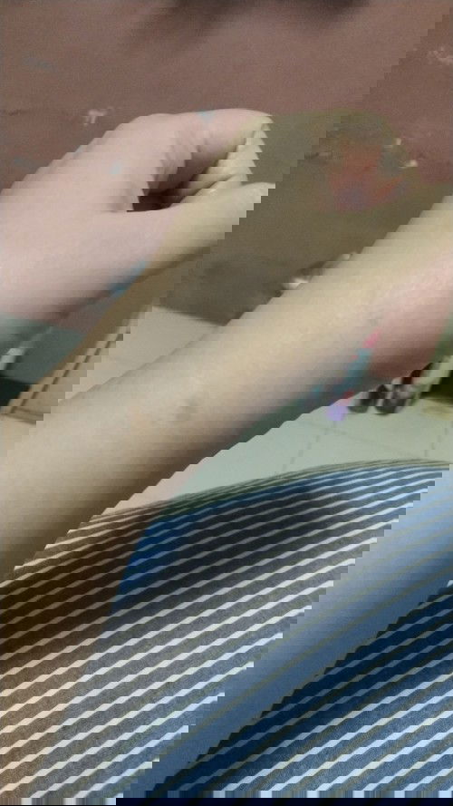 ปวดข้อมือจนขยับไม่ได้