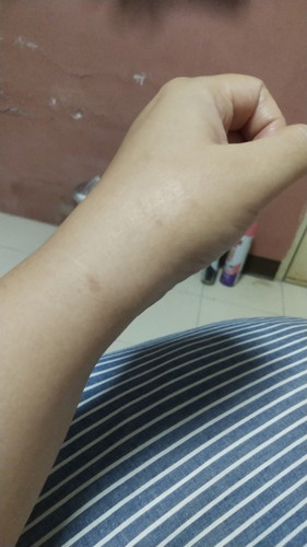 ปวดข้อมือจนขยับไม่ได้