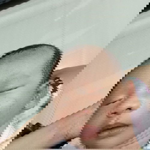 Menghilangkan bintik merah di muka