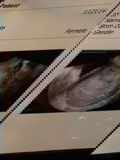 6wไม่เจอถุงตั้งครรภ์หมอกลัวท้องนอกมลลูกมีแม่ๆคนไหนเป็นแบบนี้มั้ยค่ะ