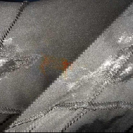 แม่บ้านไหนหมอกระตุ้นปากมดลูกบ้าง