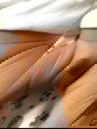 Rashes Sa private part ni baby