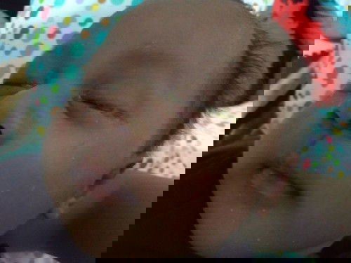 BELEK MATA [BUTUH JAWABAN]