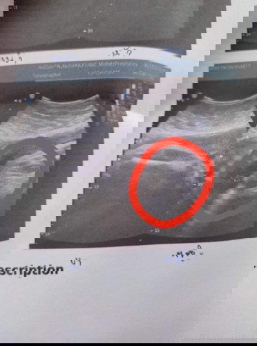 ดูให้หน่อย ผู้หญิงหรือ ผู้ชาย