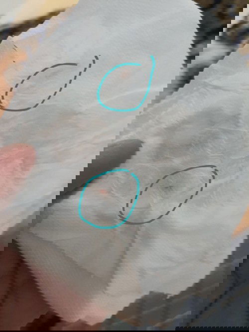 เลือดออกค่ะ