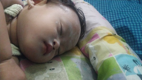 muntah pada bayi d sertai demam