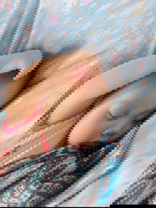 แม่กังวลใจมากค่ะ ทำไมลูกชอบเอามือเกาหัวนวดหัวแล้วไปโดนกระหม่อมลูกเอง จะเป็นอะไรไหมคะ