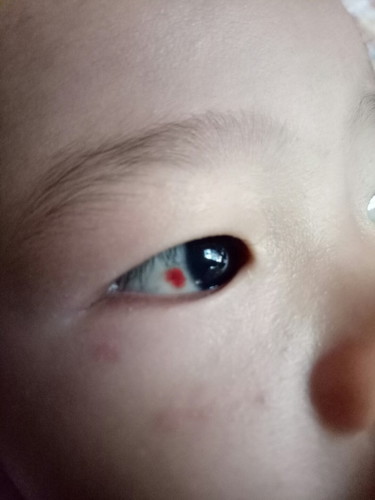 Pula sa mata ng baby ko.