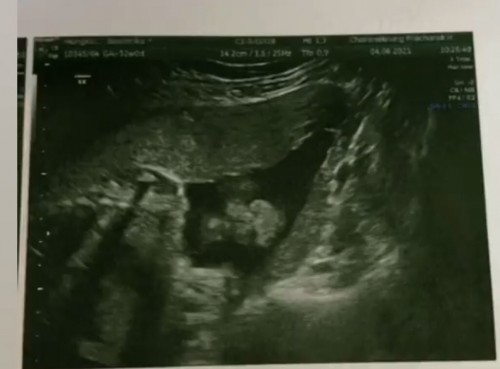 ใช่หน้าน้องไหมคะ