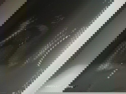 Ano po ba normal heart rate ni baby within 15weeks preggy ?