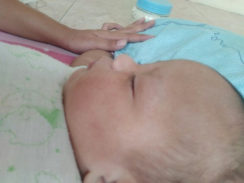 การแพ้อาหารของเด็ก