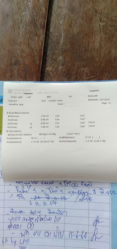 อัตราซาวด์15W2d