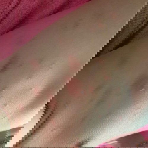 มีแม่ๆคนไหนลูกเคยเป็นแบบนี้ไหมค่ะทำไงถึงหาย