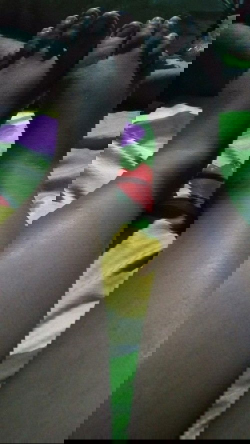 Pembengkakan kaki saat hamil