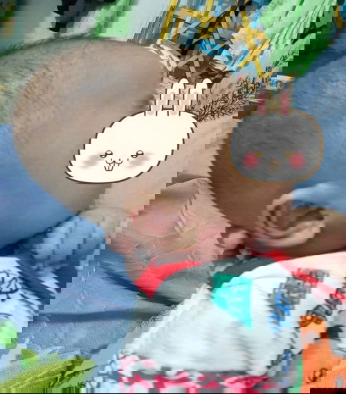 Kepala bayi panjang (lonjong)