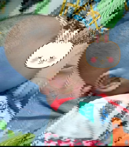 Kepala bayi panjang (lonjong)