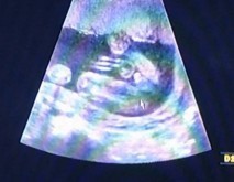 Girl or Boy?