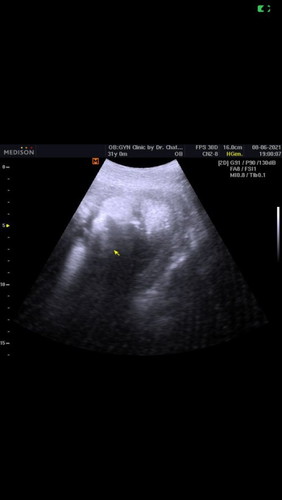 สวัสดีค่ะ. ขอสอบถามแม่ๆ. เรื่อง. น้ำหนักลูก ค่ะ. พอดีตอนนี้ ตั้งครรภ์ได้ 32สัปดาห์แล้ว. นน.ควรจะอยู่กี่กรัมค่ะถึงจะปกติ
