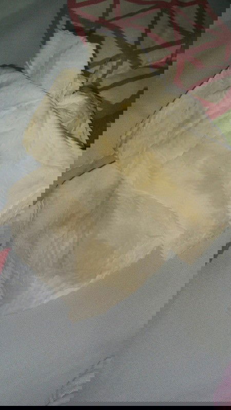 Cairan Encer dan Flek Bercampur Darah