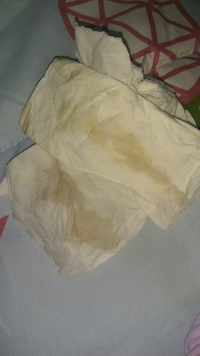 Cairan Encer dan Flek Bercampur Darah