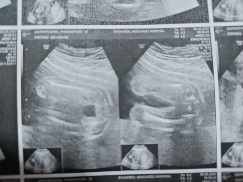 อยากทราบว่าแบบนี้ผญ.หรือผช.คะ