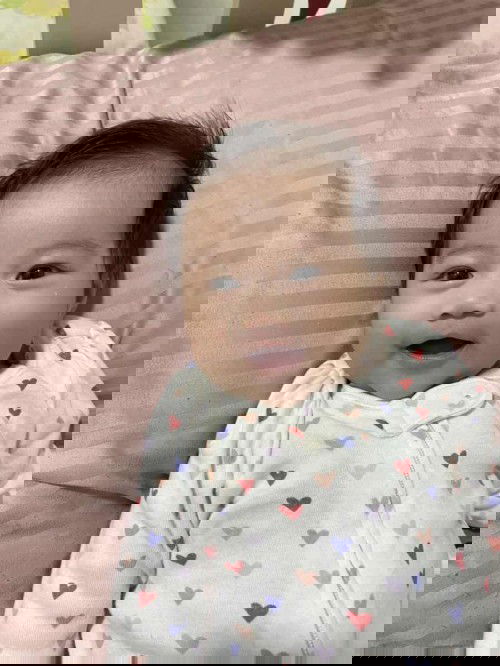 May white dot sa ilalim ng right eye ni baby