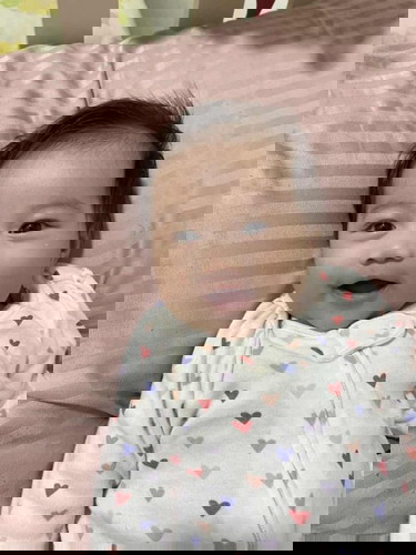 May white dot sa ilalim ng right eye ni baby