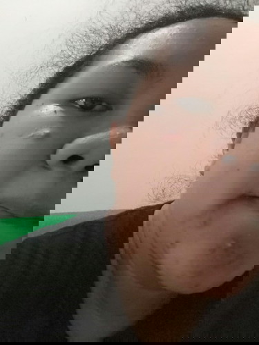 Jerawatan parah di masa menyusui