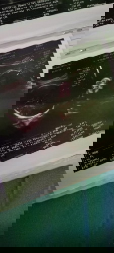 Hpl agustus awal... Ap ad yg wktu usg babynya kelilit tali pusar.... Apkah masih bisa berubah..