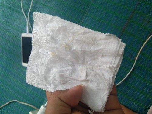 แบบนี้ควรไปหาหมอมั้ย??