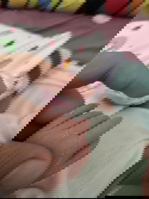 Kulit bayi terkelupas