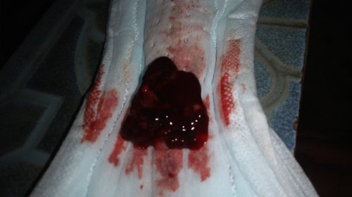 usia kandungan HPHT dengan USG