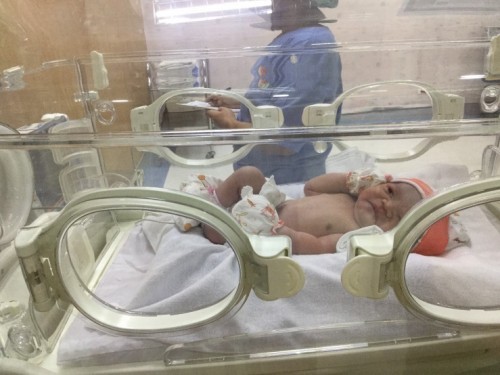 มาแล้วค่ะ ลูกสาว ผ่าคลอดวันนี้ แม่ๆบ้านไหน คลอดวันนี้บ้างคะ 
38week +1 days. ❤️🥺