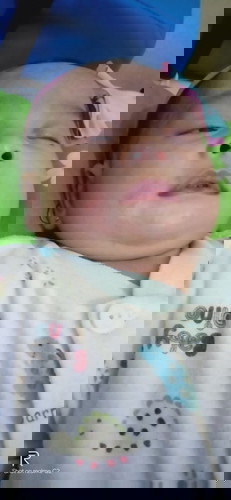 Anak saya baru berumur 2bulan, mukanya sering merah, tapi sesekali suka ilang, itu kenapa yah Bun ?