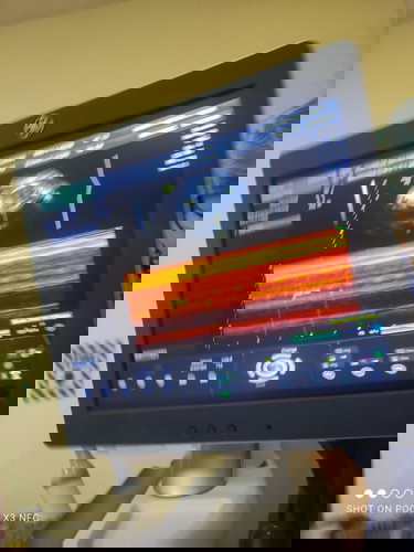 Anong Team kayo sis?