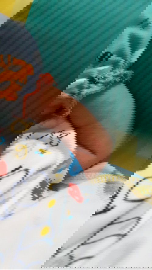 Badan anak merah2 kaya biang keringet