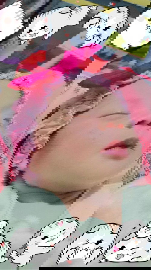 Anak aku pada beruntus kaya biangkringet ,ada yang tau buat ilangin ga bunda"?