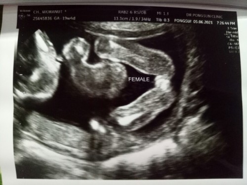 รบกวนแม่ๆช่วยดูเพศลูกให้หน่อยค่ะ