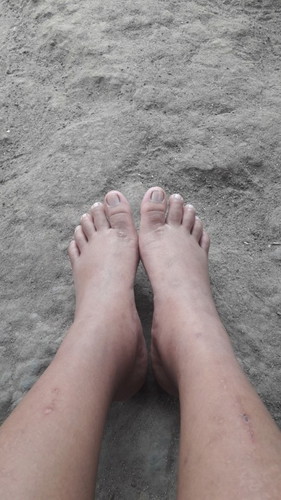 Wajar gak sih bun di kehamilan 33 minggu kaki bengkak