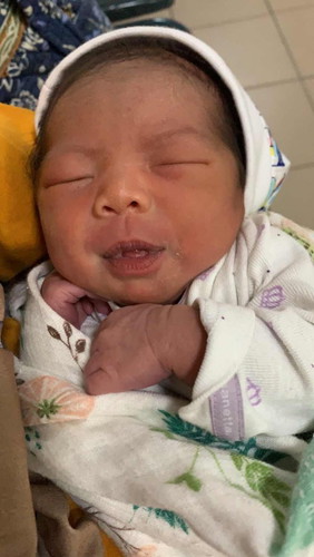 Premature delivery 36 mggu