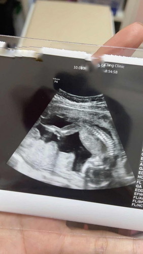 อยากให้ลูกในท้องตัวอ้วนๆ ทำยังไงได้บ้างคะ ต้องกินอะไรเป็นพิเศษไหมคะ 17week ค่ะ ไปอัลตร้าซาวมาดูผอมไป คุณแม่อยากให้อ้วนๆค่ะ