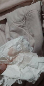 แบบนี้เรียกว่าใกล้คลอดยังคะตอนนี้39+5แล้วคะ